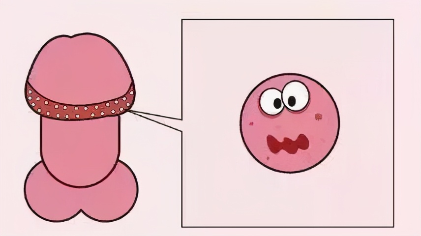 丁丁上怎么长了“小疙瘩、小红点”?难道是染上了性病?