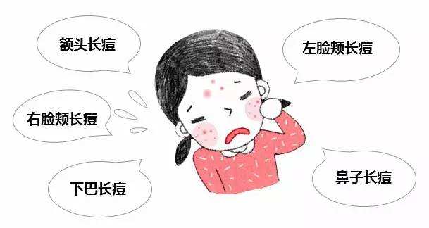 长痘痘怎么拯救痘印,长痘痘的肌肤怎么修复