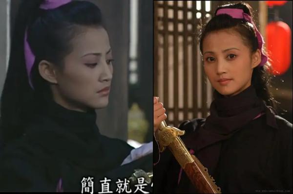 张歆艺用的什么填充脸部,张歆艺填充脸部前后对比