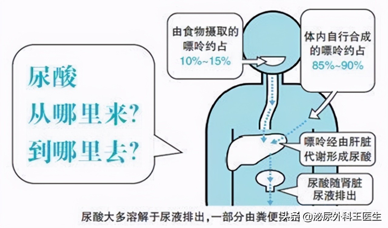 身体这些症状尿酸已高得可怕,尿酸高危害大这样降尿酸才是正解