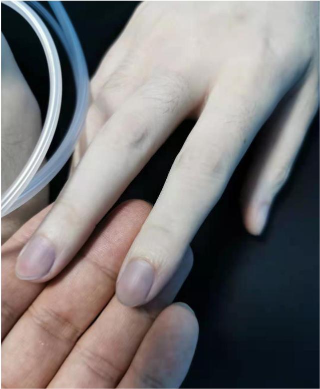 k歌之王洪卓立英皇,洪卓立拍戏前闪到腰