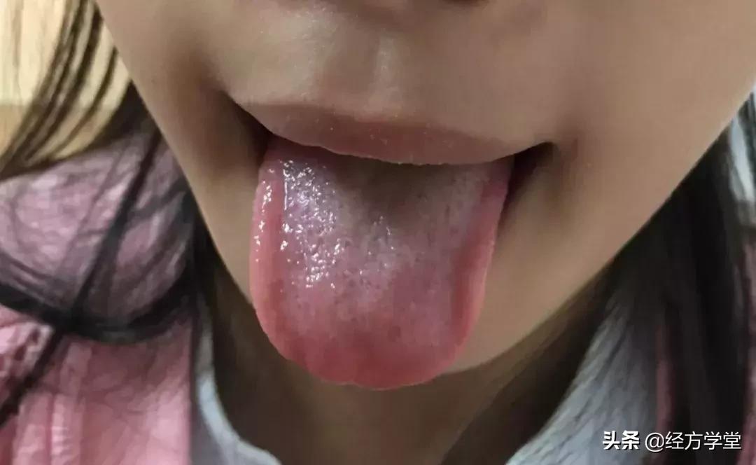 小儿感冒久治不好,小儿感冒反复发烧怎么办