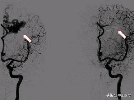 造影检查有必要做吗,输卵管造影前做什么检查项目