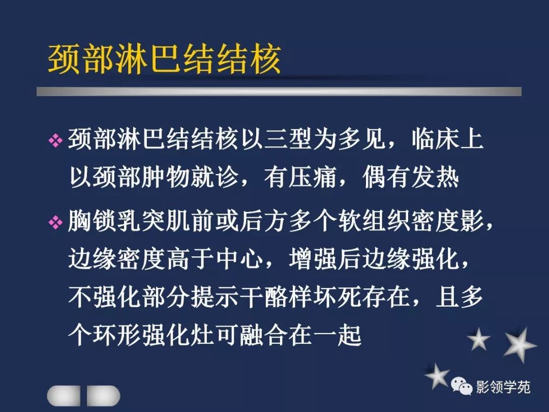 腮腺疾病影像学诊断,腮腺肿块影像诊断