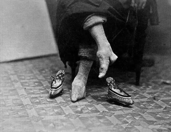 实拍三寸金莲裹脚缠足全过程,三寸金莲的详细缠足过程