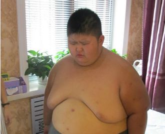 这种病让人永远吃不饱！警惕