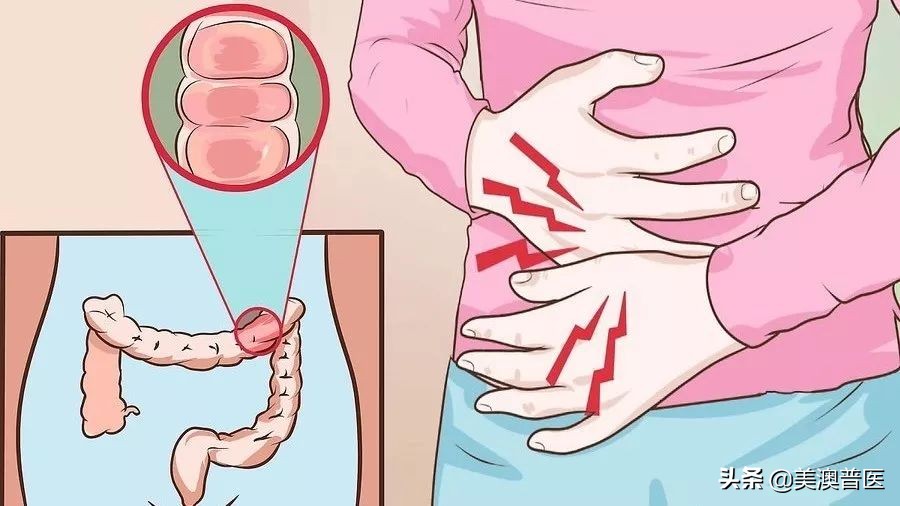 做肠镜如何快速清肠,便秘做肠镜清肠能清干净吗