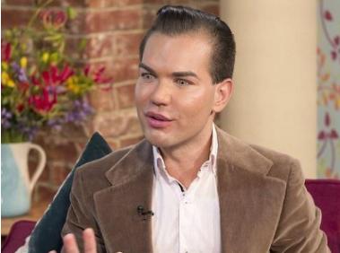 巴西男芭比娃娃,巴西整容狂人芭比娃娃