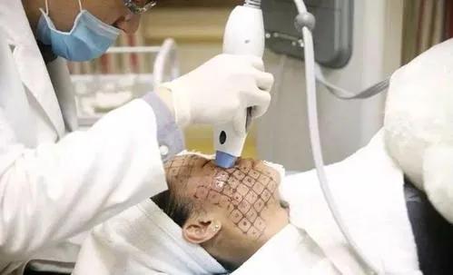 激光美容术后该如何修复护理？