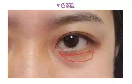 眼霜都是骗局吗视频,眼霜误区99%的人不知道