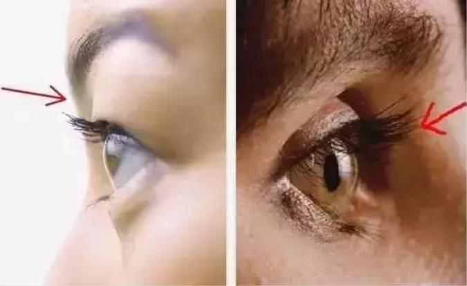 眉弓多高最合适,眉弓怎么判断高低