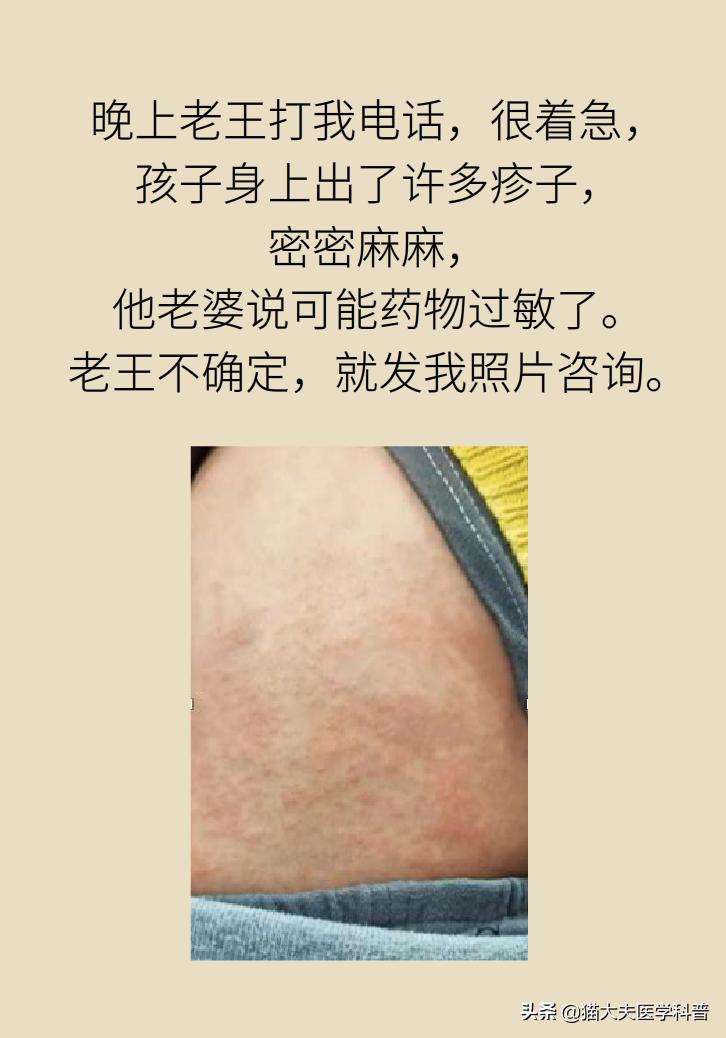 儿童高烧退热按摩手法,8个月婴儿发烧最快退烧方法