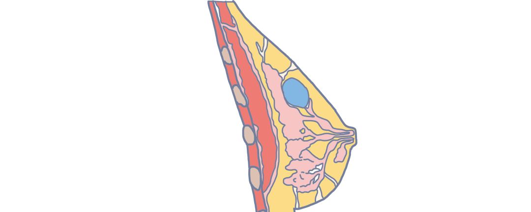 体检时发现结节增生囊肿怎么回事,查出息肉结节怎么办