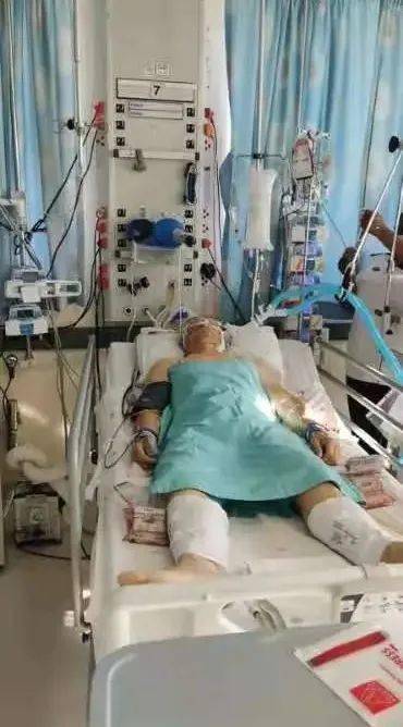 眼镜蛇被蛇咬,最担心的事终于发生了