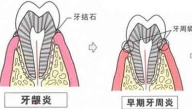 你经历过的疼痛,牙齿疼起来是一种什么感受