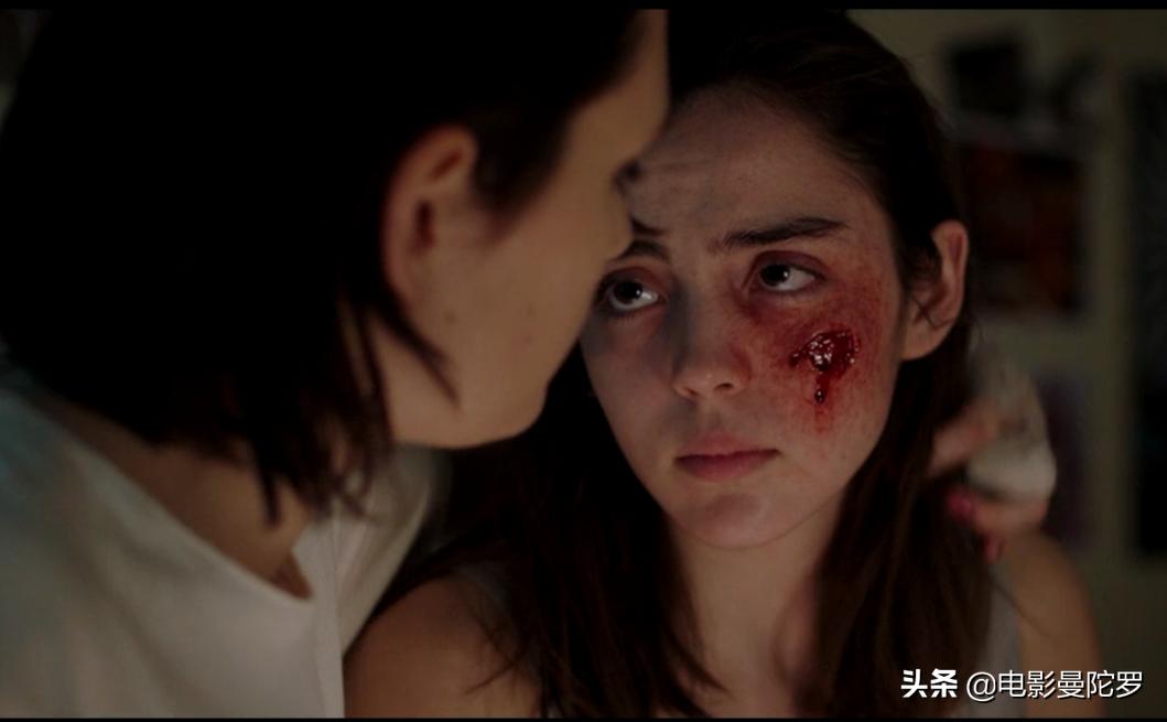 女孩对肉过敏,女孩被人强迫吃过敏食物