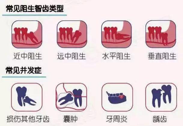 上海中山医院口腔拔智齿科普,大连齿医生口腔联系电话