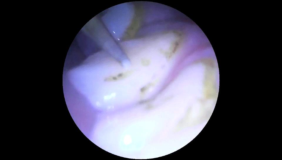 超声波洁牙器官方旗舰店,小米有品超声波洁牙仪
