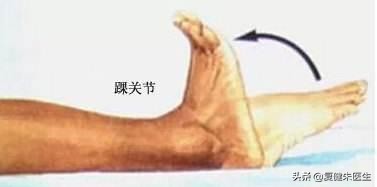 踝扭伤的康复治疗最佳疗法,踝扭伤妙招