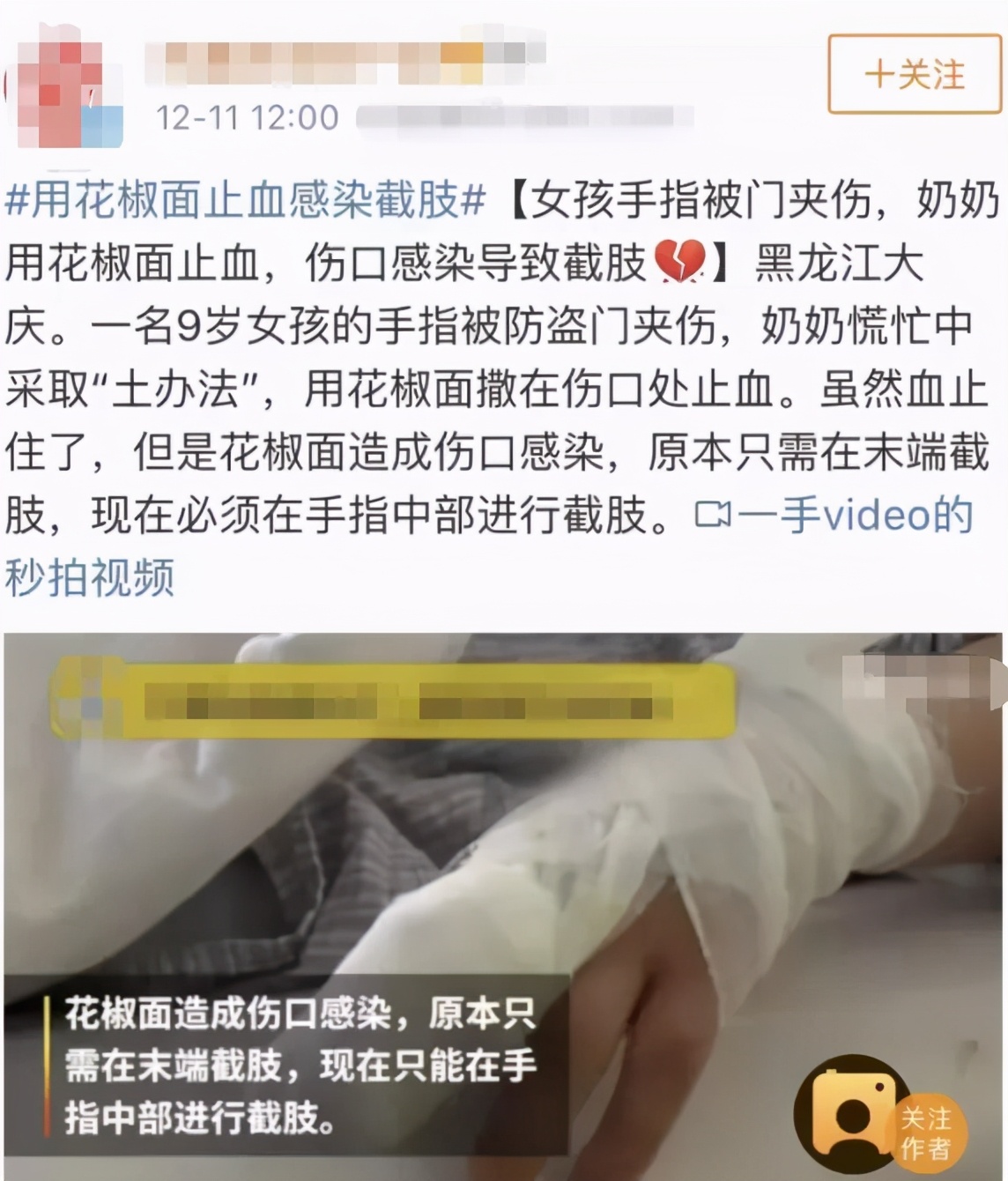 手指肚破了一直流血,手指肚裂小口怎么治