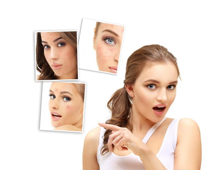 怎么样不长痘痘跟粉刺,如何不会长痘痘