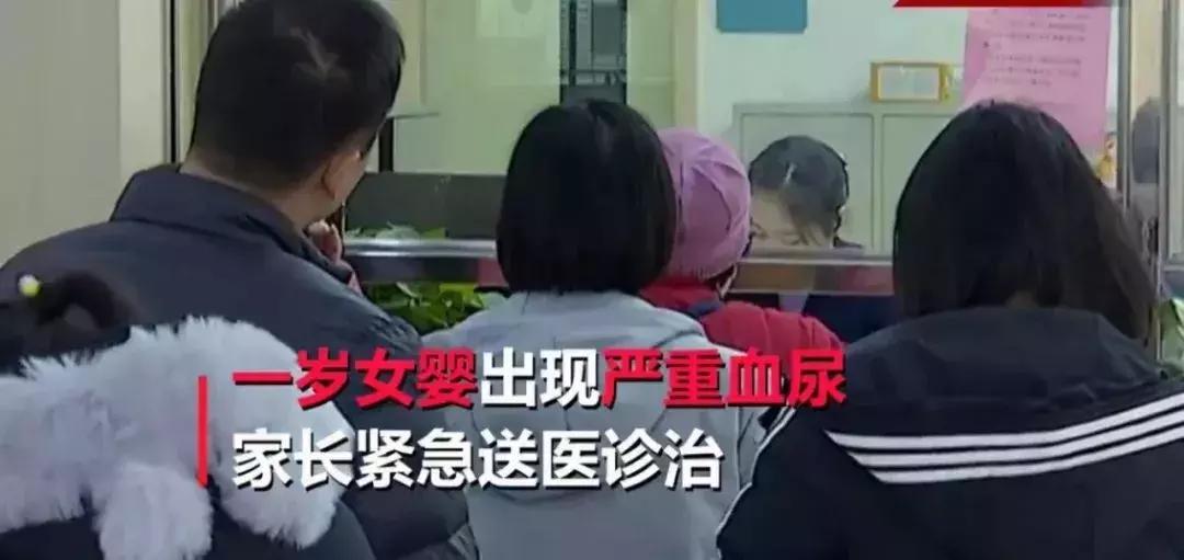 1岁孩子双肾长满结石,五个月婴儿双肾长满结石