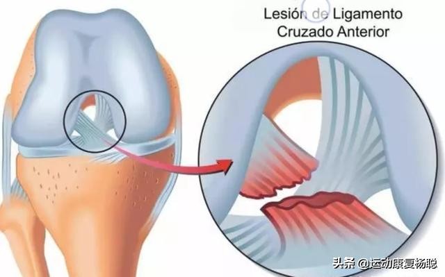 膝关节疼痛分类,膝关节疼痛是什么症状