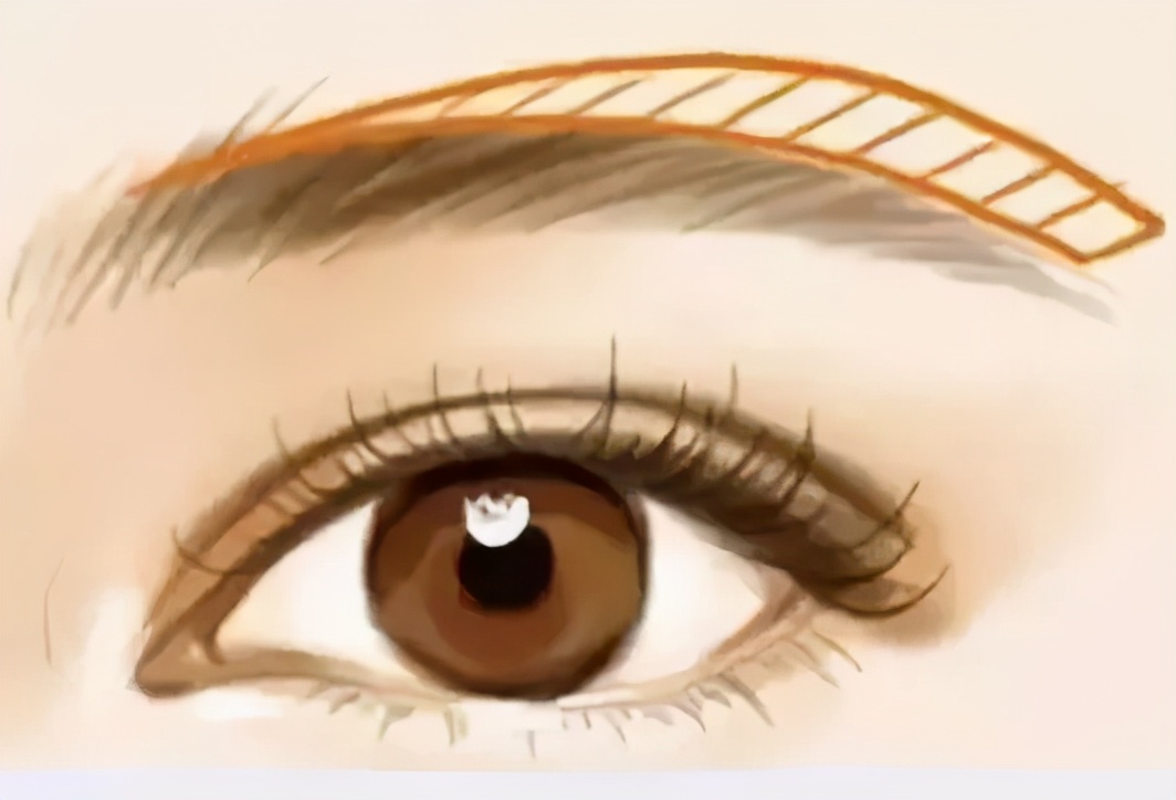 一举三得的起针方法,一举三得