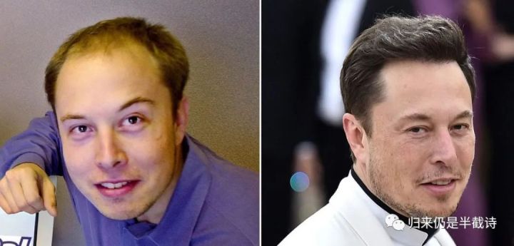 欧洲男士秃顶脱发之谜：别错怪水质太硬啦