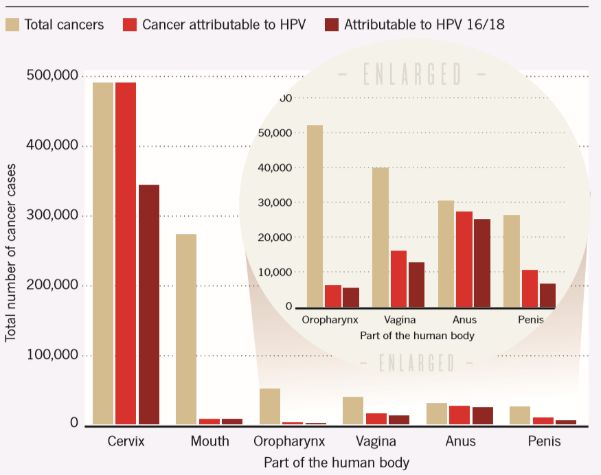 宫颈癌最深度解读,宫颈癌筛查报告正确解读