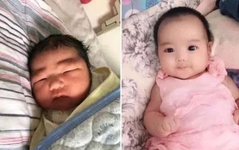 刚出生的婴儿极丑图片,刚生出来的婴儿为什么这么丑
