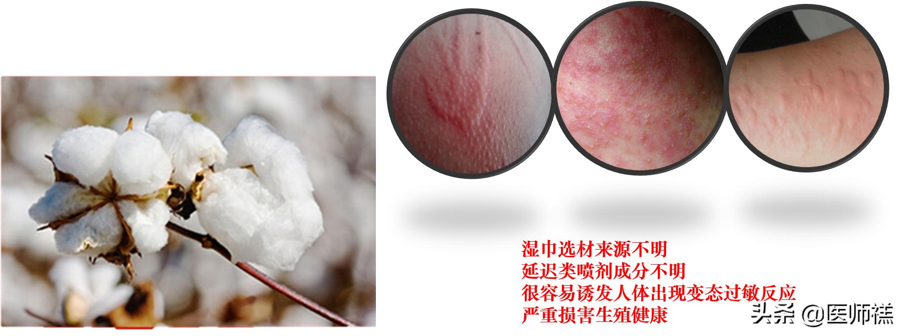 延时湿巾靠不靠谱，会带来哪些健康损害？医生提醒需要警惕这些