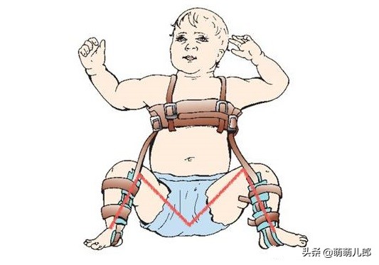 腰凳怎么用不伤腰,为什么不建议用腰凳