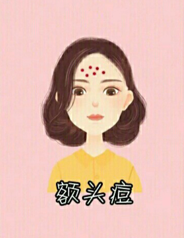 男生脸上各个部位长痘痘图解,脸上不同部位长痘痘的原因