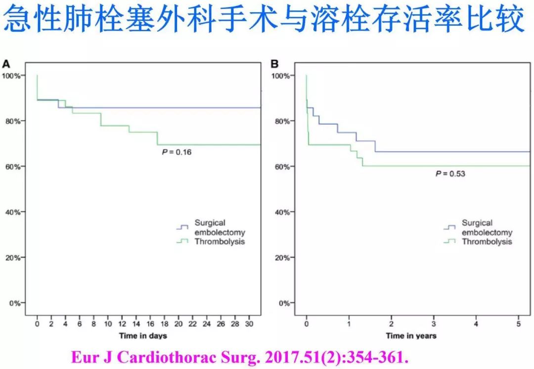 静脉血栓栓塞症发生的3个要素,静脉血栓十大抗凝误区