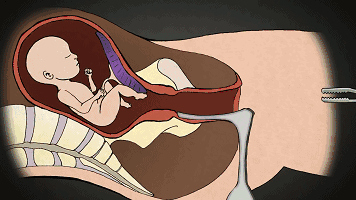 男人爱不爱你看他肯不肯为你花钱,产房可以看出男人爱不爱你