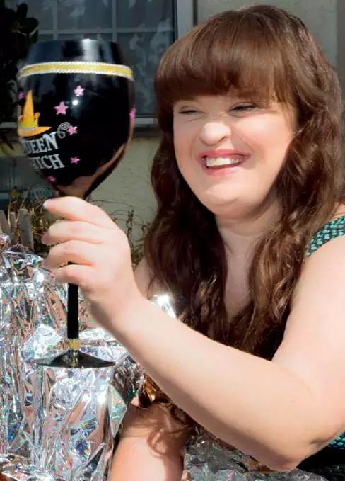 唐氏综合征中国美女,患有唐氏综合征的维密模特