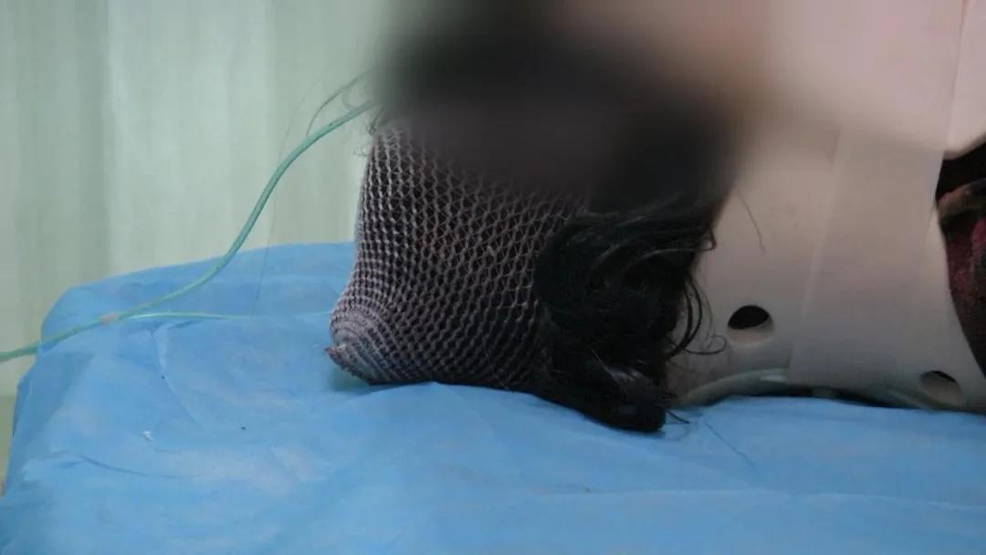 地动山摇中，她不幸从高处摔下头部受伤昏迷，危急时刻，她能转危为安吗？