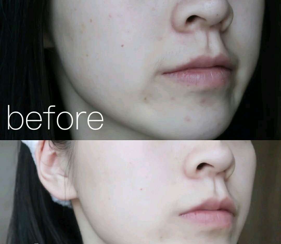 平价面膜潘达,平价有效果面膜