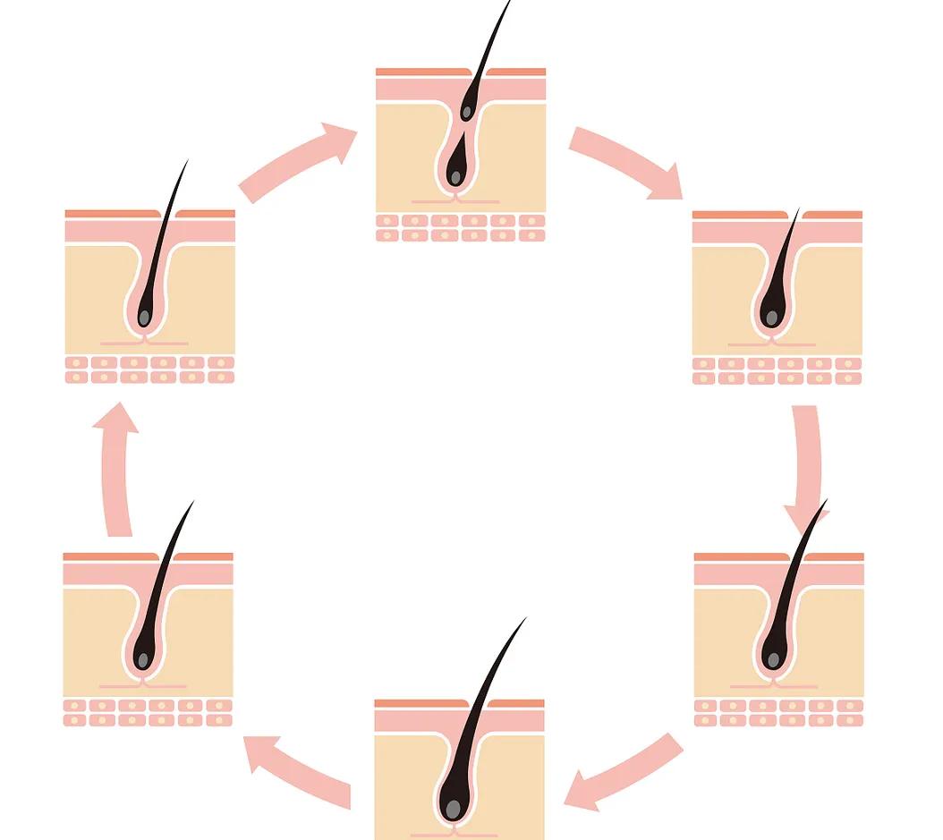 油腻脂溢性脱发,脂溢性脱发怎么抑制出油