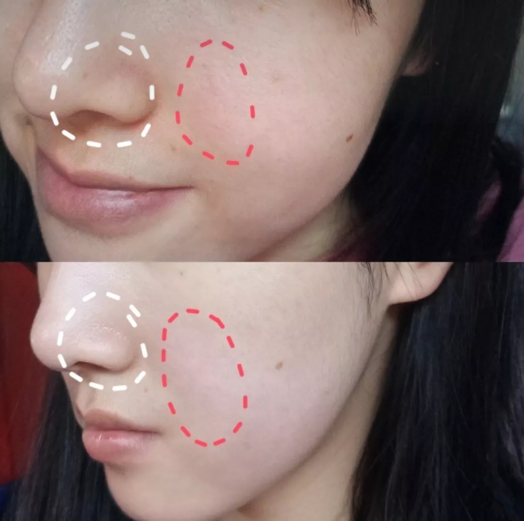 去黄提亮紧致茶面膜,韩国茶树面膜