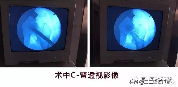 从医30余年，他治疗数以万计骨伤骨病患者