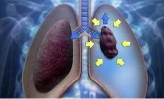 用大气管给气球充气危险吗,气球充太饱会爆破吗