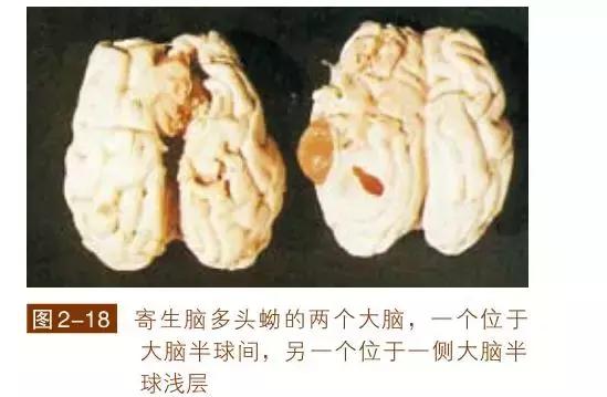 执业兽医的复习资料之【兽医寄生虫学