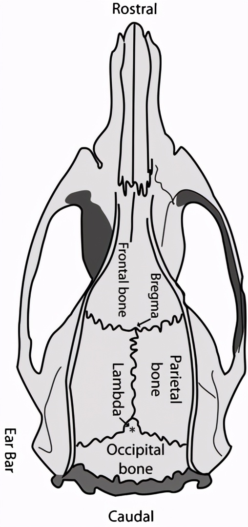 晶体植入手术的分享,可调微丝阵列电极