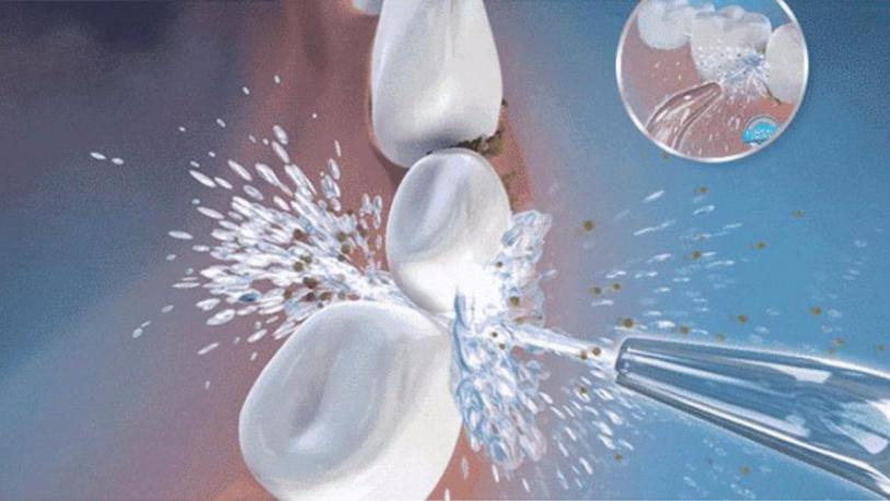 从不刷牙的人牙齿很好,从不刷牙的嘴有多臭