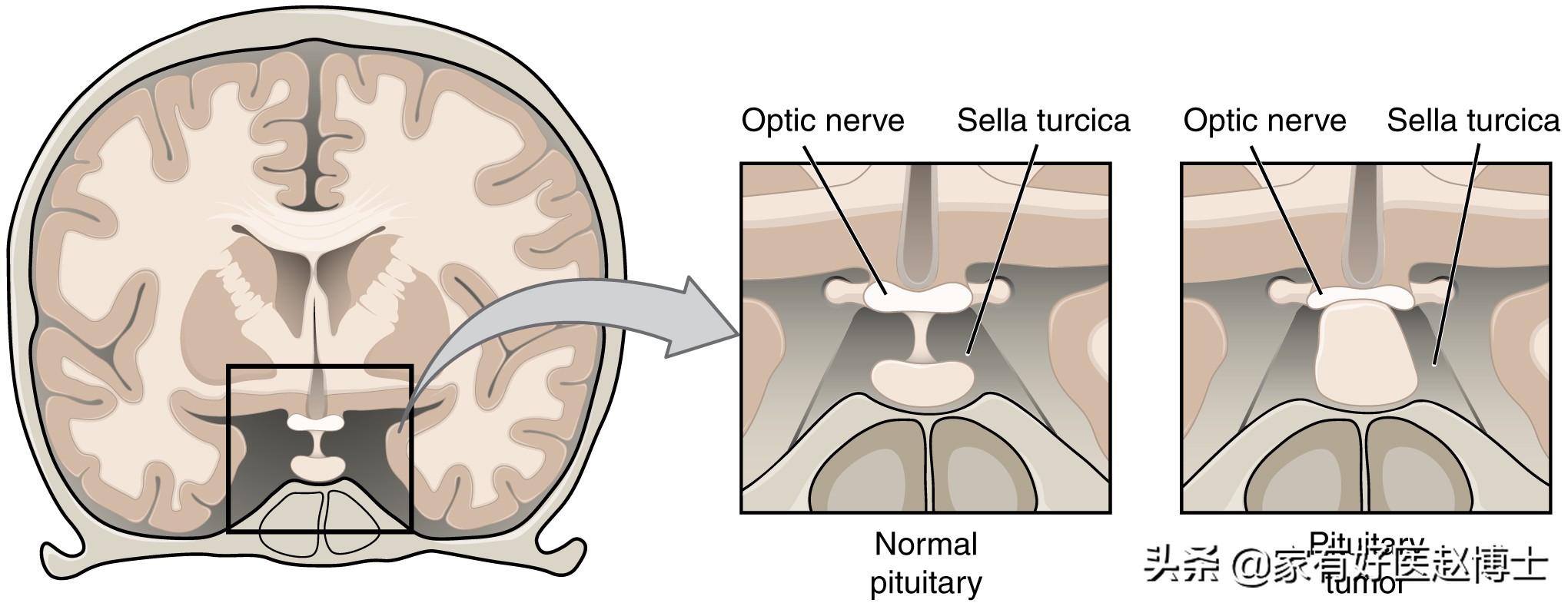 助眠药物褪黑素可以自己买到吗,褪黑素助眠片有用吗