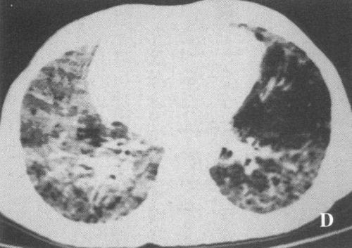 口干眼干皮肤干就是干燥综合症吗,口干眼干但不口渴是干燥综合症吗