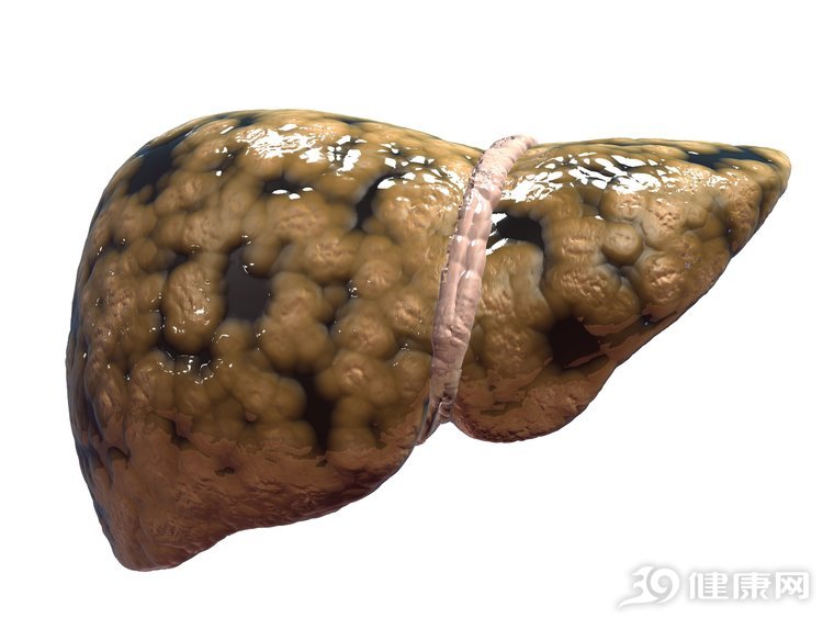 重视:肝会硬化,多是几个原因惹的祸,请重视
