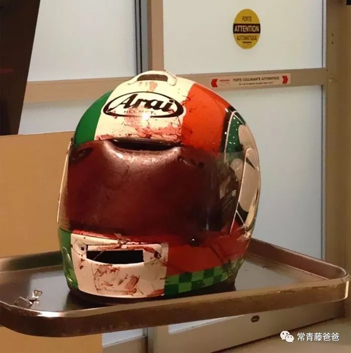 小朋友在美国险些脑袋开花，全靠麻省这条法律捡回一条命